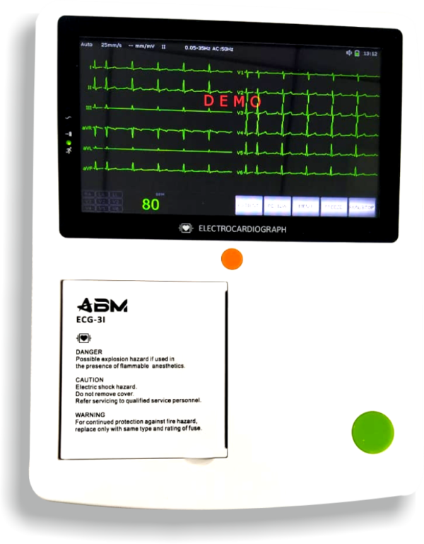 ecg 3i